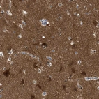 Anti-RAP1GDS1 Antibody