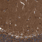 Immunohistochemical staining of human cerebellum shows strong cytoplasmic positivity in cells in molecular layer.
