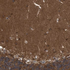 Immunohistochemical staining of human cerebellum shows strong cytoplasmic positivity in cells in molecular layer.