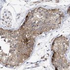 Immunohistochemical staining of human testis shows moderate cytoplasmic positivity in cells in seminiferous ducts.