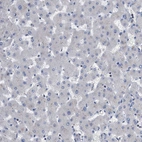 Immunohistochemical staining of human liver shows no positivity in hepatocytes as expected.