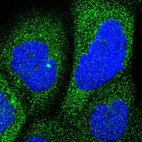 Immunofluorescent staining of human cell line A-431 shows positivity in cytoplasm.