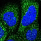 Immunofluorescent staining of human cell line A-431 shows positivity in cytoplasm.