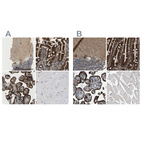 Immunohistochemical staining of human cerebellum, duodenum, placenta and skeletal muscle using Anti-PICALM antibody HPA019061 (A) shows similar protein distribution across tissues to independent antibody HPA019053 (B).