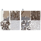 Immunohistochemical staining of human cerebellum, duodenum, placenta and skeletal muscle using Anti-PICALM antibody HPA019061 (A) shows similar protein distribution across tissues to independent antibody HPA019053 (B).