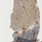 Immunohistochemical staining of human cerebellum shows moderate cytoplasmic positivity in Purkinje cells.