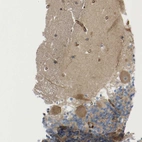 Immunohistochemical staining of human cerebellum shows moderate cytoplasmic positivity in Purkinje cells.