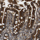 Immunohistochemical staining of human duodenum shows strong membranous and cytoplasmic positivity in glandular cells.