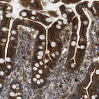 Immunohistochemical staining of human duodenum shows strong membranous and cytoplasmic positivity in glandular cells.