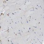 Immunohistochemical staining of human skeletal muscle shows no positivity in myocytes as expected.
