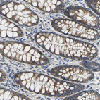 Immunohistochemical staining of human rectum shows moderate cytoplasmic/membranous positivity in glandular cells.