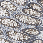 Immunohistochemical staining of human rectum shows moderate cytoplasmic/membranous positivity in glandular cells.