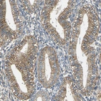 Immunohistochemical staining of human endometrium shows moderate cytoplasmic/membranous positivity in glandular cells.