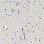 Immunohistochemical staining of human cerebral cortex shows moderate cytoplasmic positivity in endothelial cells.