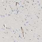 Immunohistochemical staining of human cerebral cortex shows moderate cytoplasmic positivity in endothelial cells.
