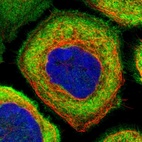Immunofluorescent staining of human cell line A-431 shows localization to plasma membrane & cytosol.