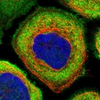 Immunofluorescent staining of human cell line A-431 shows localization to plasma membrane & cytosol.