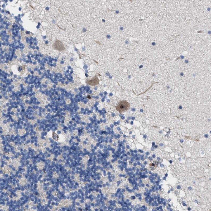 Anti-TWISTNB Antibody