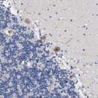 Anti-TWISTNB Antibody