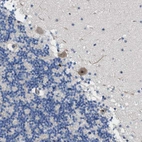 Anti-TWISTNB Antibody