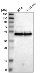 Western blot analysis in human cell line RT-4 and human cell line U-251 MG.