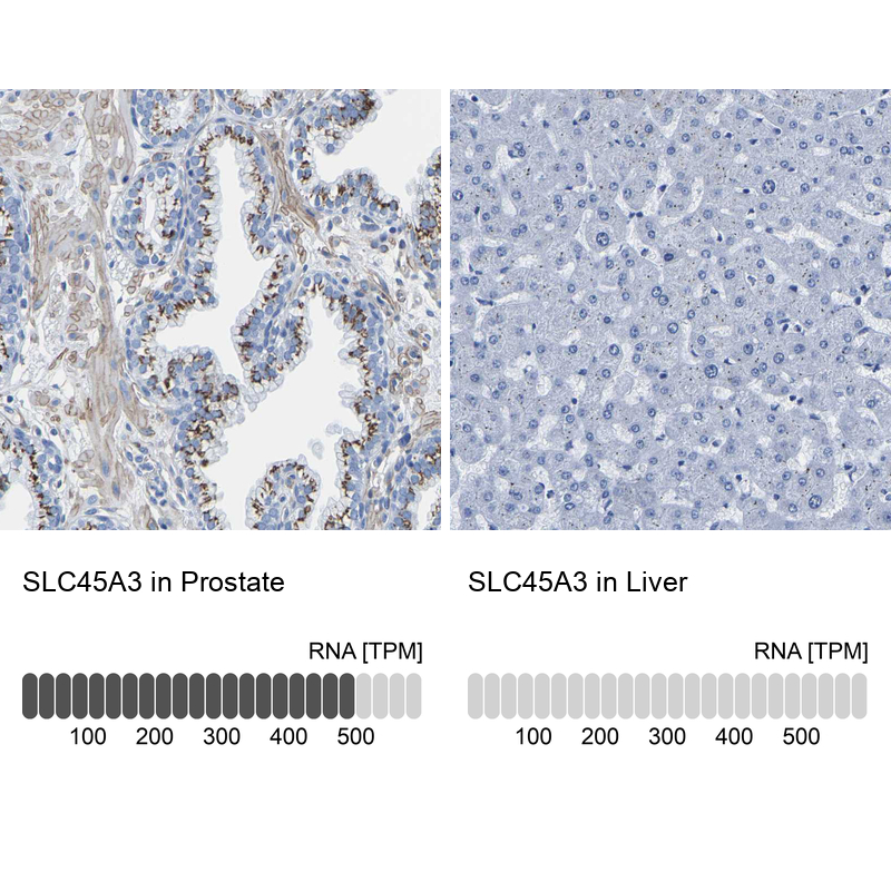 Anti-SLC45A3 Antibody