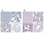 Immunohistochemical staining of human liver, placenta, prostate and testis using Anti-SLC45A3 antibody HPA019073 (A) shows similar protein distribution across tissues to independent antibody HPA019075 (B).