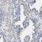 Immunohistochemical staining of human prostate shows strong granular cytoplasmic positivity in glandular cells.