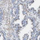 Immunohistochemical staining of human prostate shows strong granular cytoplasmic positivity in glandular cells.