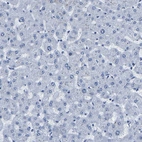 Immunohistochemical staining of human liver shows no positivity in hepatocytes as expected.
