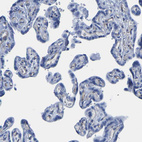 Anti-SLC45A3 Antibody