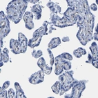 Immunohistochemical staining of human placenta shows no positivity in trophoblastic cells as expected.