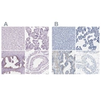 Immunohistochemical staining of human liver, placenta, prostate and testis using Anti-SLC45A3 antibody HPA019075 (A) shows similar protein distribution across tissues to independent antibody HPA019073 (B).