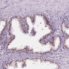 Immunohistochemical staining of human prostate shows strong granular cytoplasmic positivity in glandular cells.