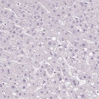 Immunohistochemical staining of human liver shows no positivity in hepatocytes as expected.