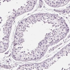 Immunohistochemical staining of human testis shows no positivity in cells in seminiferous ducts as expected.