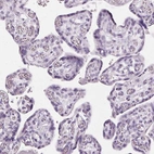 Immunohistochemical staining of human placenta shows no positivity in trophoblastic cells as expected.