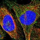Immunofluorescent staining of human cell line U-2 OS shows localization to vesicles.