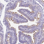 Immunohistochemical staining of human fallopian tube shows high expression.