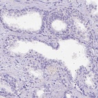 Anti-DLEC1 Antibody