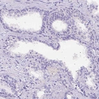 Immunohistochemical staining of human prostate shows low expression as expected.