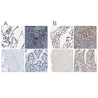 Immunohistochemical staining of human lung, lymph node, skeletal muscle and small intestine using Anti-CAPG antibody HPA019080 (A) shows similar protein distribution across tissues to independent antibody HPA018843 (B).