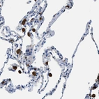 Immunohistochemical staining of human lung shows moderate to strong cytoplasmic positivity in macrophages.