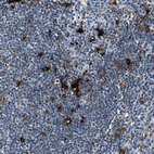 Immunohistochemical staining of human lymph node shows moderate to strong cytoplasmic positivity in macrophages.