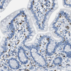 Immunohistochemical staining of human small intestine shows moderate to strong cytoplasmic positivity in cells in lamina propria.