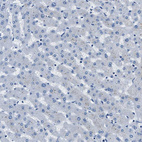 Immunohistochemical staining of human liver shows no positivity in hepatocytes as expected.
