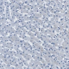 Immunohistochemical staining of human liver shows no positivity in hepatocytes as expected.