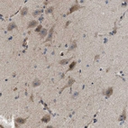 Immunohistochemical staining of human cerebral cortex shows moderate granular cytoplasmic positivity in neuronal cells.