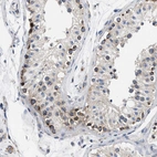 Immunohistochemical staining of human testis shows moderate granular cytoplasmic positivity in cells in seminiferous ducts.