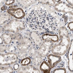 Immunohistochemical staining of human kidney shows strong granular cytoplasmic positivity in cells in distal tubules.